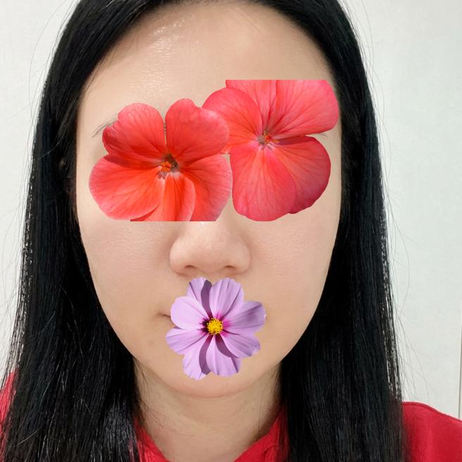 쥬브아셀 5일차 솔직 후기 ! 아직은 기다리는 중
