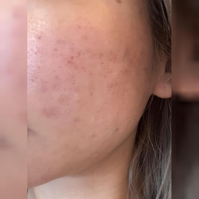 정품 인증에 맞춤 케어까지! 원하는 시술 수면으로 받아봤어요~