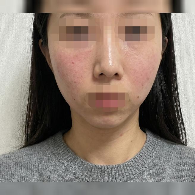 대기 시간도 짧아서 자주 가요~ 그리고 꾸준히 받으니까 효과 보는 것 같아요ㅎㅎ