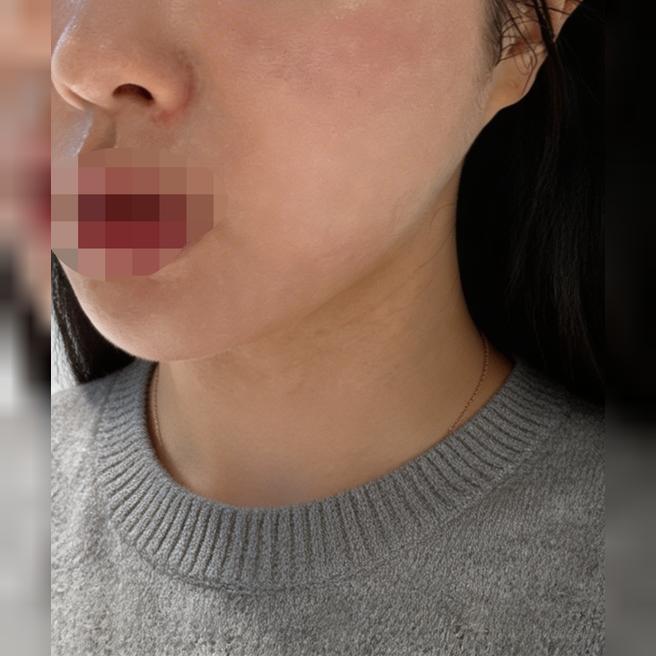 포텐자랑 리쥬베룩 같이 받았는데 권유 없이 편하게 받았어요 ㅎㅎ