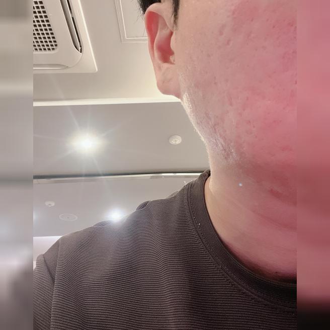 쥬베룩 받았는데 친절하고 편하게 받아서 재방문할게요~