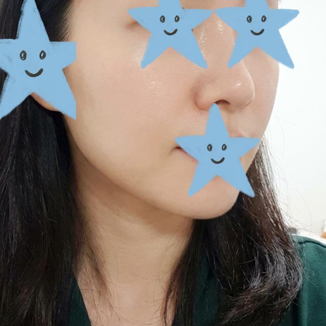 피부결 강조 모공이 줄었다고요? 쥬베룩 4주 후기 솔직하게