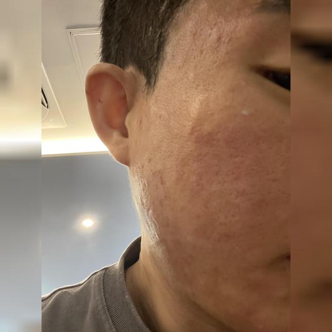대기 짧고 상담 꼼꼼하고 후관리까지 깔끔하게 해주셔서 만족이에요.