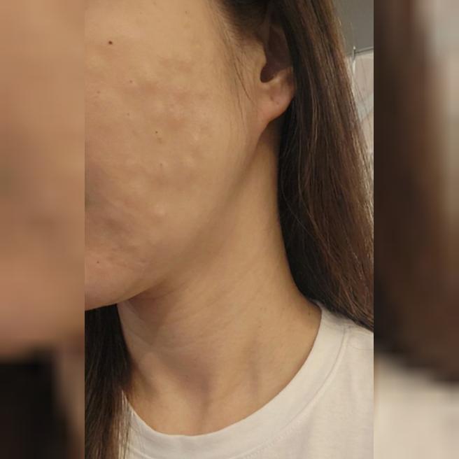 정품 인증까지 챙겨주시는 세심함, 신뢰감 가득해요~수면 진행으로 너무 만족합니다ㅎㅎ