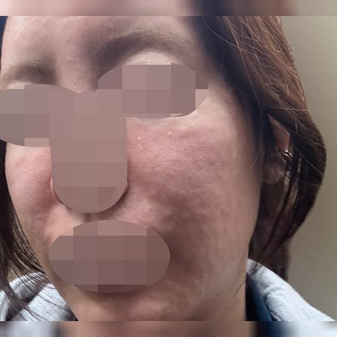 마취 전문의 있어서 믿고 받았네요ㅎㅎ 환절기라 푸석해서 받았는데 만족인 것 같아요!