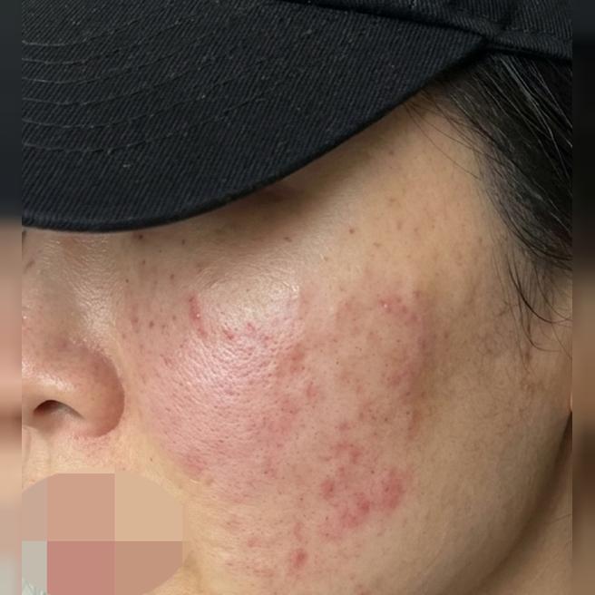 공이랑 푸석함 고민에 리쥬베룩, 꾸준히 다니는 단골 병원이에요~
