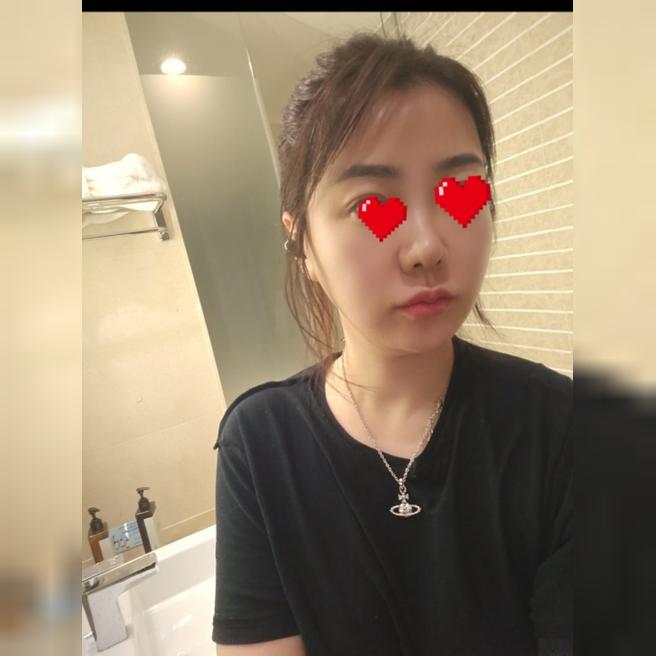 리쥬란 3회 완료 후기 – 잔주름에 톤까지, 재방문 확정입니다