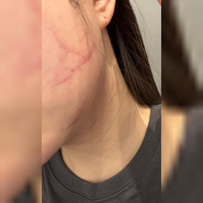 효과 오래 가는 수면 인모드+리쥬란, 여기서만 받고 있어요ㅎㅎ