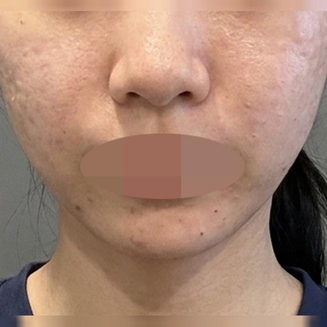 직원분들도 의사 선생님도 꼼꼼하셔서 자꾸만 찾게 되는 곳이에요ㅎㅎ