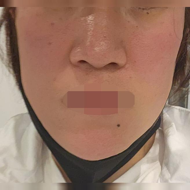 마·미간 주름이랑 속건조 고민으로 방문, 첫날부터 만족스럽게 다녀왔어요!!
