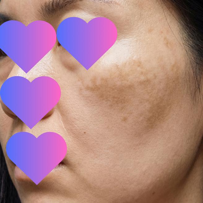 엑소좀 맞고 2일째인데 피부가 뭔가 달라지는 느낌..?