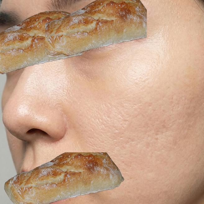 리쥬란 맞고 5일째 ㅎㅎ 붉은기 남았지만 뭔가 촉촉한 것 같기도?