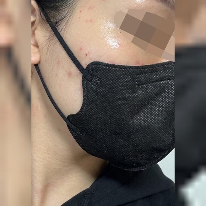 스태프분들 친절함에 통역까지 완벽해서 다음에도 꼭 다시 오려고요ㅎㅎ