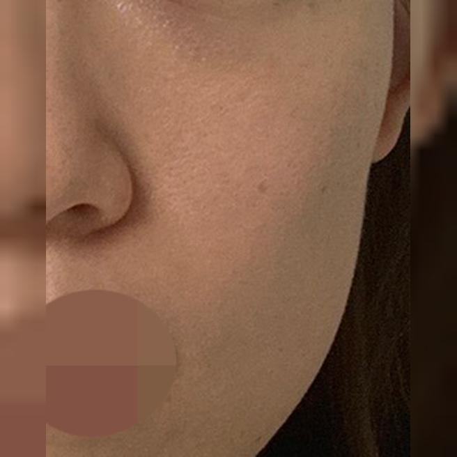 속건조랑 눈가 잔주름 때문에 받았는데 친절해서 좋았어요 ㅎㅎ