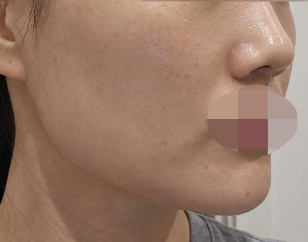 피부 컨디션 올리려고 쥬베룩 받았는데, 속건조가 잡혔어요!
