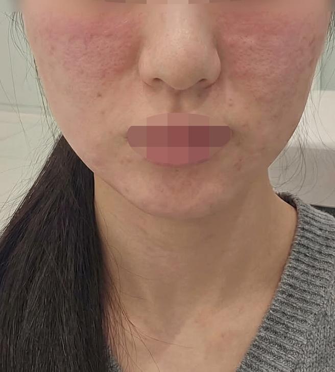 전에도 좋았는데 역시 피부 촉촉해져서 계속 다니는 것 같아요~