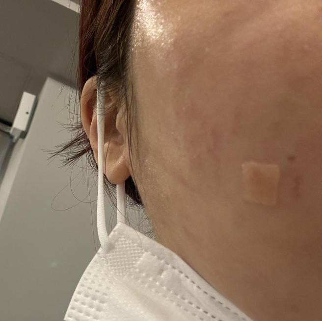 대기 없고 편안한 분위기에 시술까지 꼼꼼하게 해주세요!!