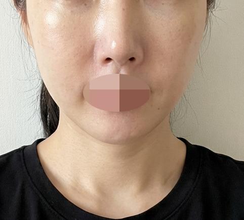 모공 사이사이 메이크업 뜨는 거 진짜 스트레스로 방문했습니다~