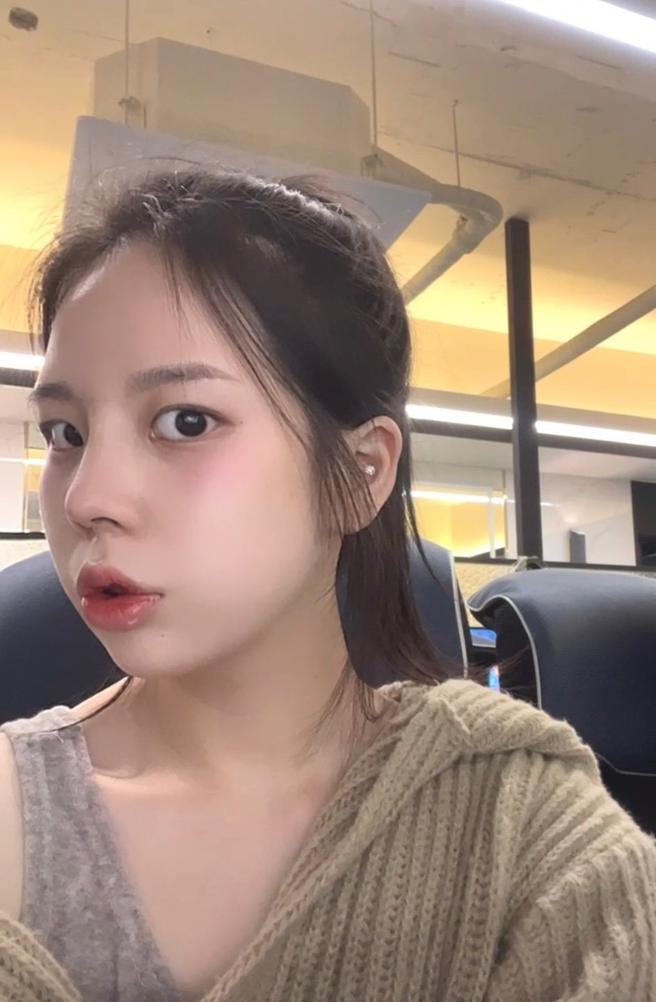 비절개콧볼축소