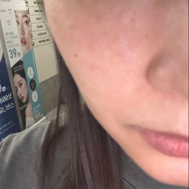 제 피부 보더니 동생도 같이 다니기 시작했어요 (쥬베룩 후기)