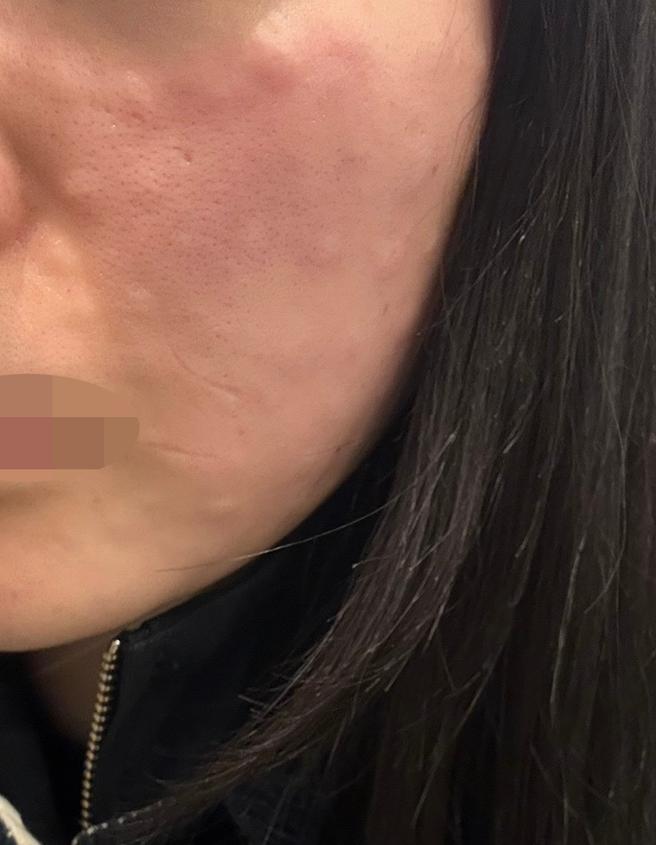 수분 고민으로 왔는데 추가 결제 없이 빠르게 받아서 좋아요 ㅎㅎ