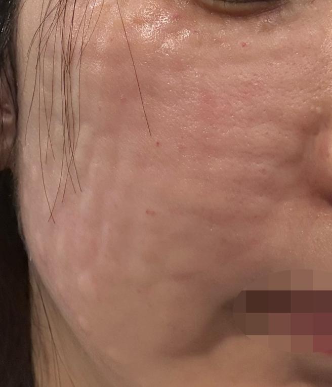 정품인증 확인시켜주시고 코드도 주셔서 믿음이 가요! 다음엔 리쥬란 또 받아보려고요ㅎㅎ