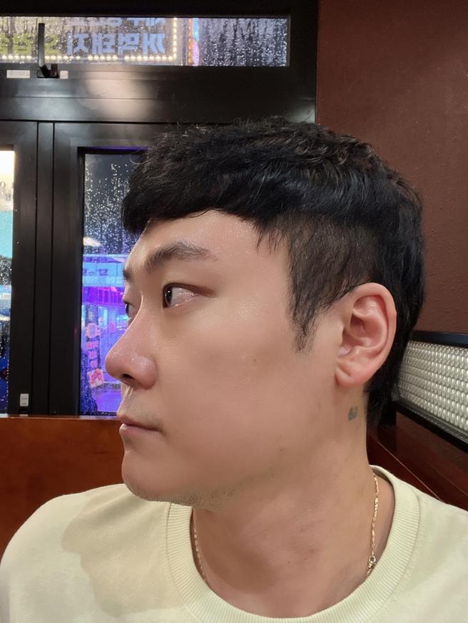 男性目元矯正