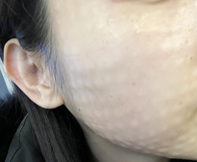 건조함이랑 재생력 때문에 왔는데 꼼꼼하게 해주셔서 만족이에요~