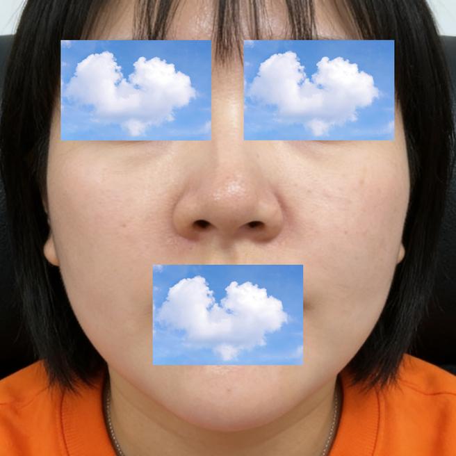 3일차인데 생각보다 괜찮은 것 같아요~ 포텐자 경과 공유!