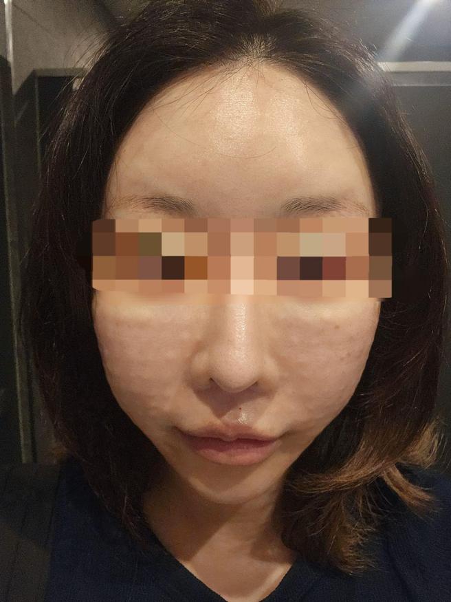 친절하고 신속한 리쥬란, 효과가 벌써 기대됩니다