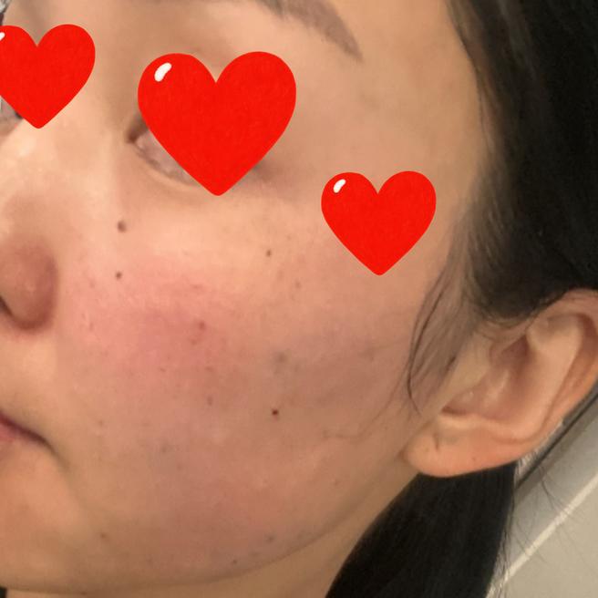 리쥬란 3일차, 붉은기도 점점 가라앉는 중~