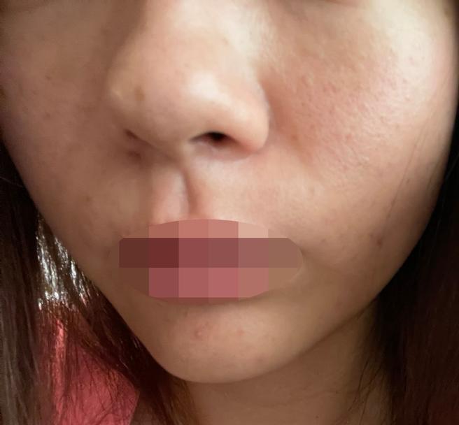 일본어 직원분 덕분에 리쥬란,쥬베룩 편하게 받아봤어요~
