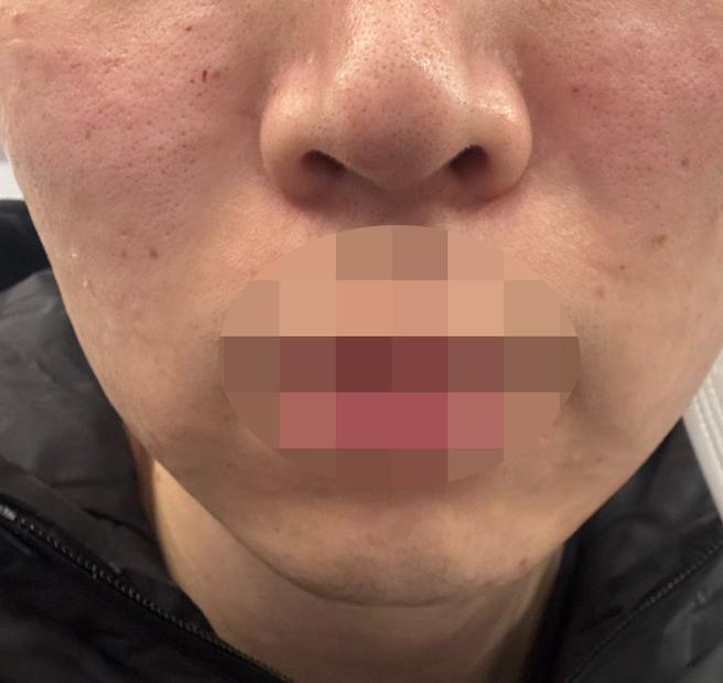 예약시간 맞춰 안내해주시고 필요한 시술만 상담해줘서 좋았어요!