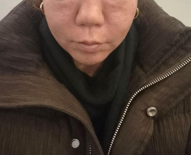 1년에 한 번 필수 루틴! 리쥬란은 고민 없이 여기서만 받아요