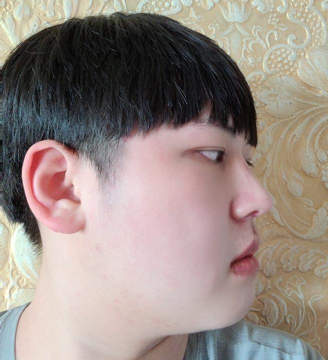 男性眼睛矫正