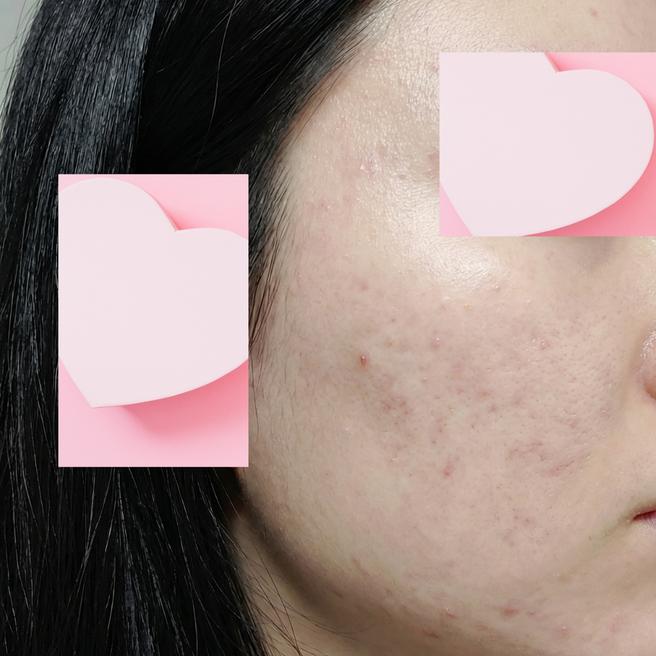 리쥬네 3일차, 진정되고 있는 것 같아요