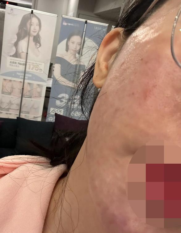 수면인데 가격까지 합리적, 주기적으로 받기 좋은 곳이에요~ 벌써 3번째 방문!