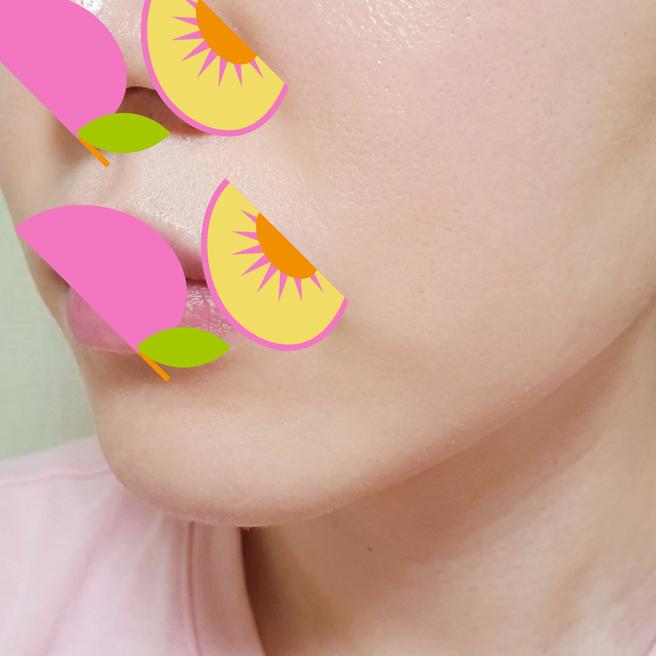 포텐자 5일차 후기- 생각보다 회복이 빠른 것 같아요
