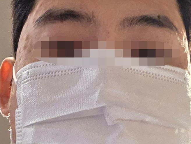 여드름 피부 때문에 추천받아서 리쥬란 받아봤습니다.