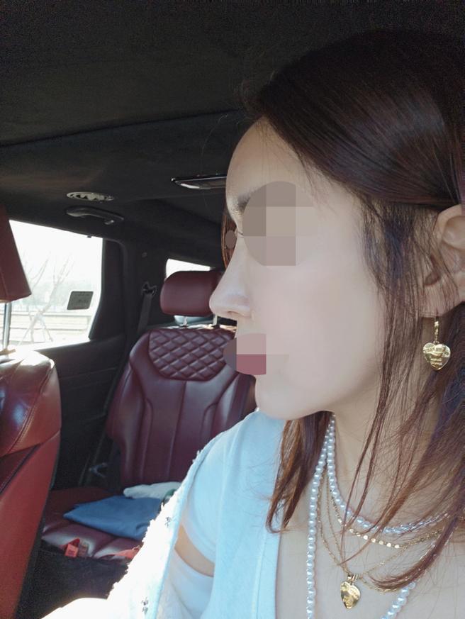 안심 코 재수술