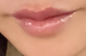 짧은 대기에 만족스러운 상담, 입술필러는 여기서 받기로 했어요~