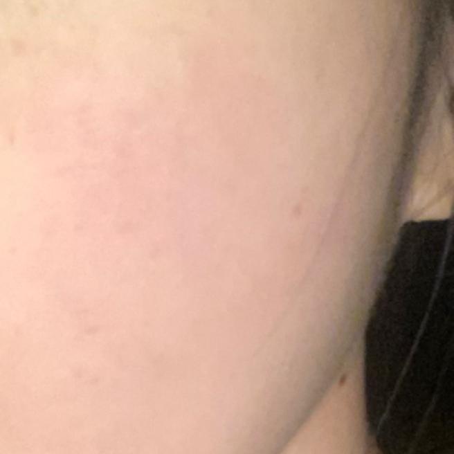 화장이 안 먹는 피부, 리쥬란으로 바꿔보기로 했어요