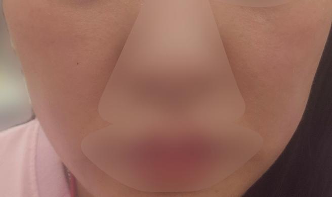 일주일 만에 건조함 사라지고 보들 탱탱한 피부가 됐어요!
