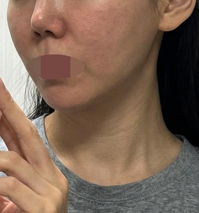 처짐이랑 피부 두 가지 고민, 수면으로 한번에 해결했어요!