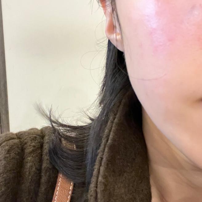 눈밑 잔주름이랑 레이저 후 재생관리때문에 받았어요!