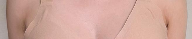 Reduce Chest