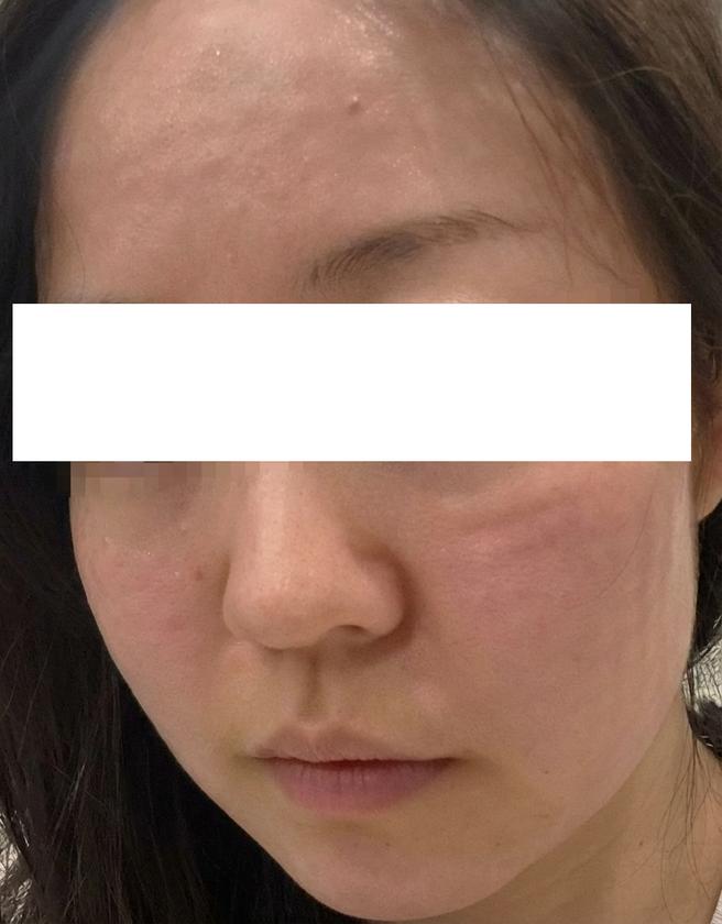 속건조 고민으로 왔는데 강요 없이 편하게 받았어요~ 웨딩 전 관리로 또 오려고요ㅎㅎ