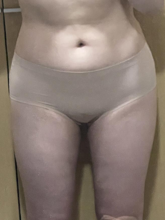 人體脂肪移植
