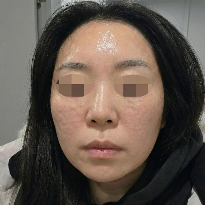 리쥬란 잘하는 곳 찾다가 왔는데 추가 강요 없어서 좋았어요~