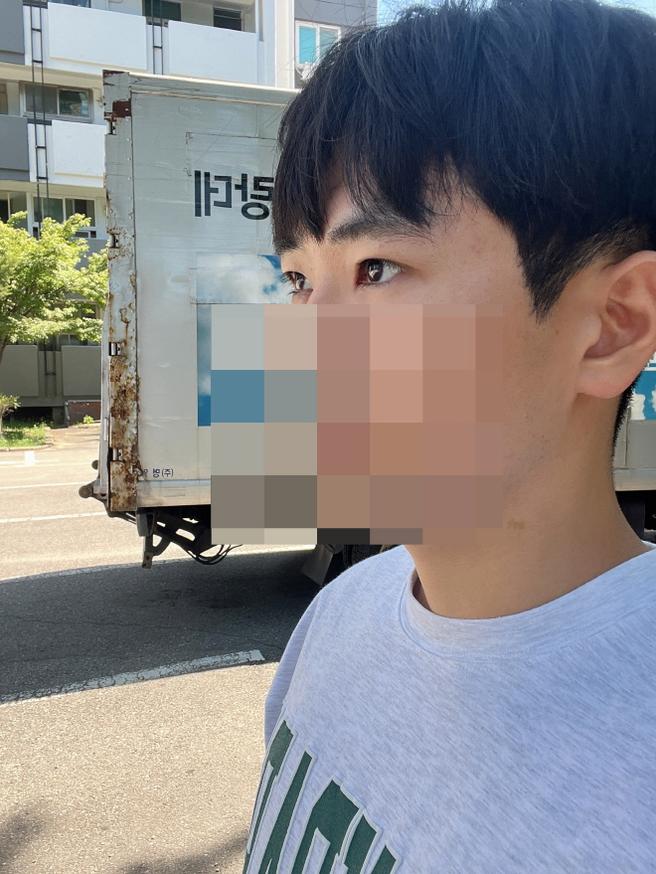 男性眼睛矫正